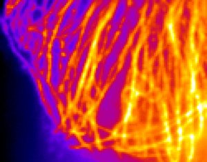 Conventional microscope image that is unable to resolve microtubule structures within a cell